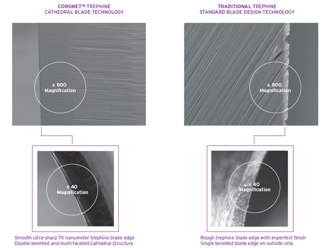 CORONET Cathedral Blade Technology