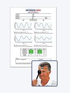 Diopsys ERG - Contrast Sensitivity Test Result