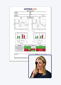 Diopsys VEP Multi-Contrast Test Result