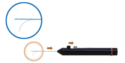 Laser Probes - Directional Laser Probe