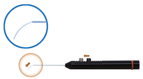 Laser Probes - Directional Extendable Laser Probe